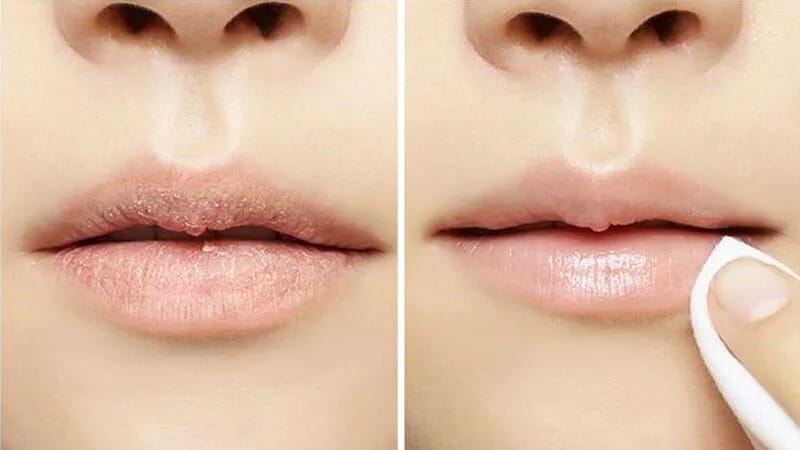 Teilen Sie 12 effektive Möglichkeiten, Ihre Lippen zu Hause zu peelen
